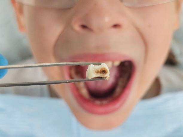 Best Affordable Emergency Dental Care  in Eerlin, ND