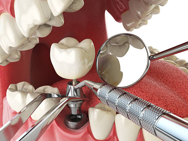 Best Tooth Pain Emergency Relief  in Eerlin, ND